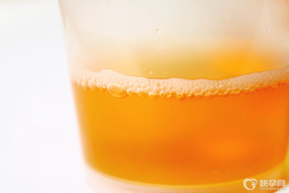 产后尿液有泡沫正常吗？专家解读为什么产后容易有泡沫尿