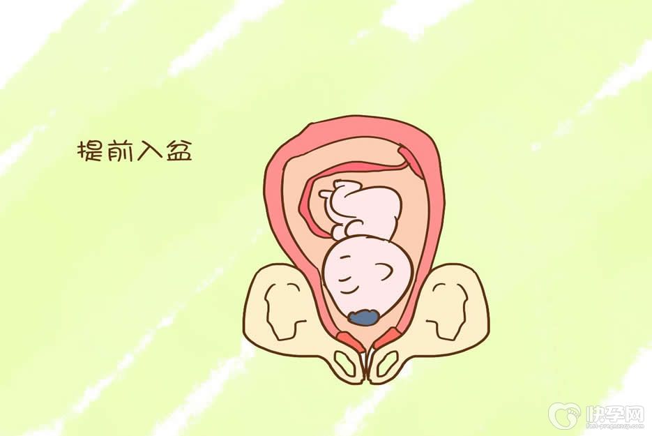 初产妇34周入盆会不会早产呀？其实这之间并没有必然联系