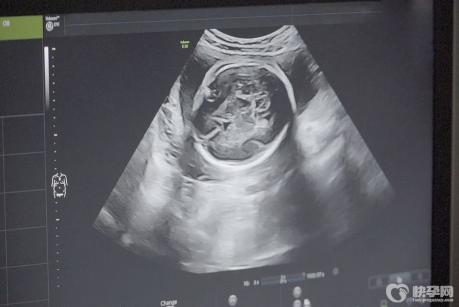 b超有两点基本是男孩，都是谣言，别傻傻相信