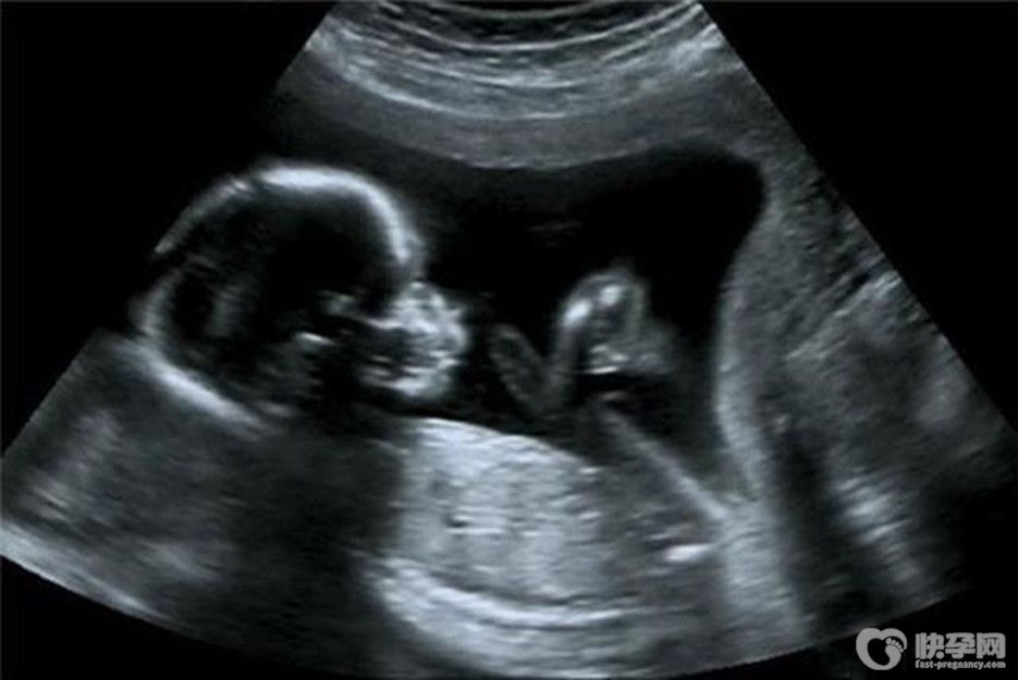热点：b超对胎儿有影响吗？看看质深医生怎么说