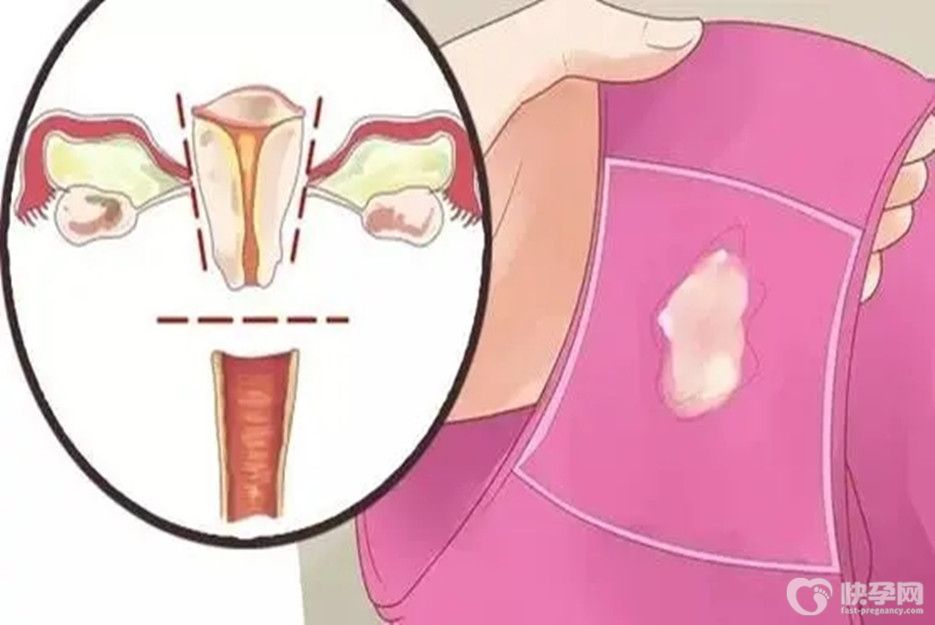 正常孕妇分泌物 [附图片]-重点知识