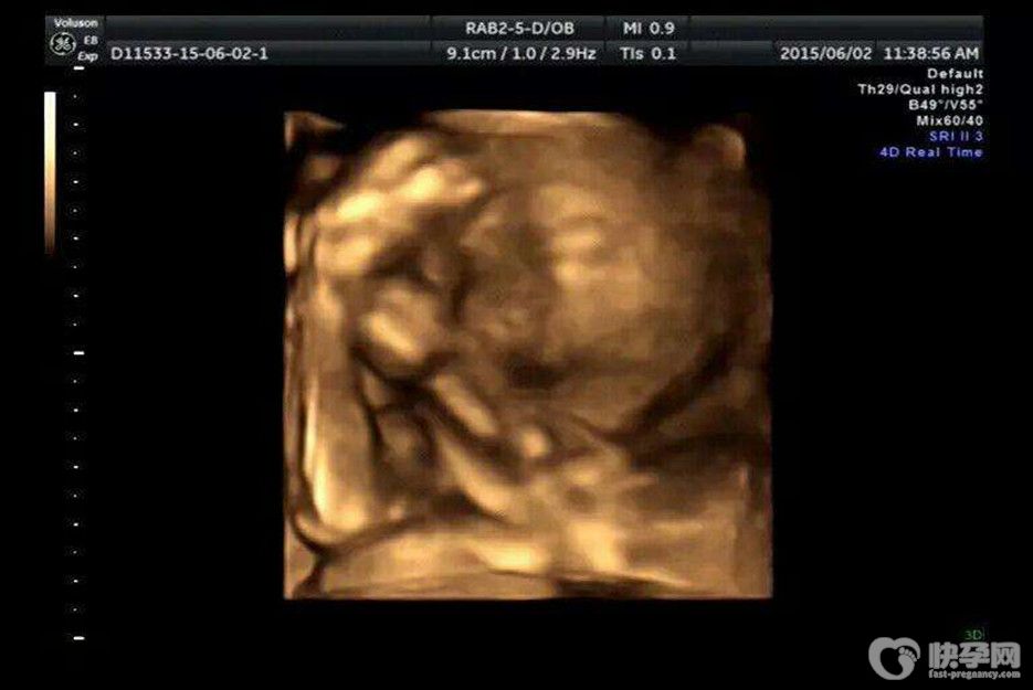 四维3个亮点是男孩-教你在四维单中寻踪觅迹