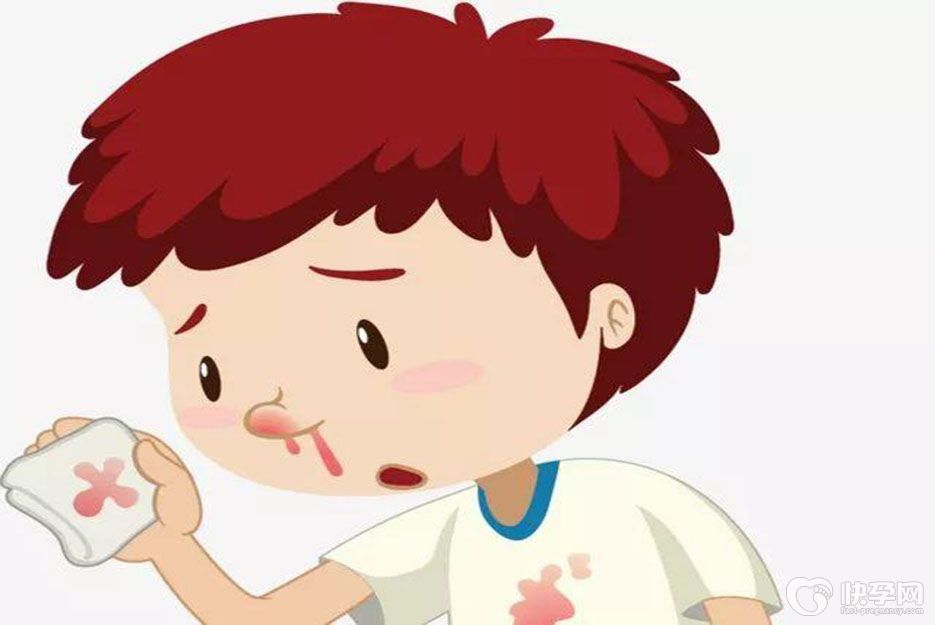 导致小孩鼻子出血的七种原因，不妨了解下