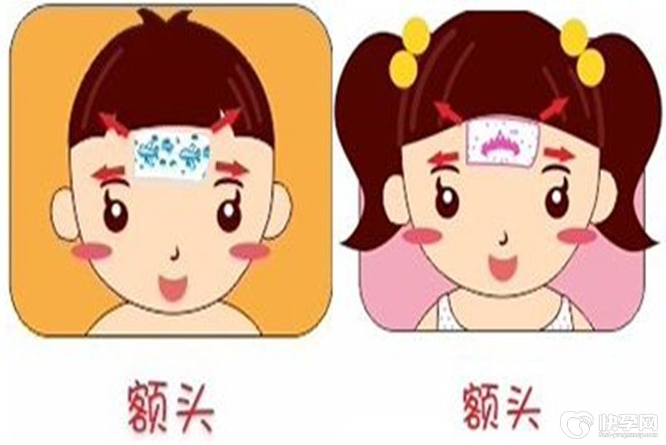 小儿发烧退热贴位置-这三个部位是关键，内附图片