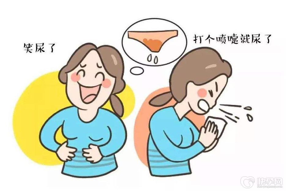 警惕！5旬女子盆底功能障碍引发尿失禁，“难言之隐”千万不能忍