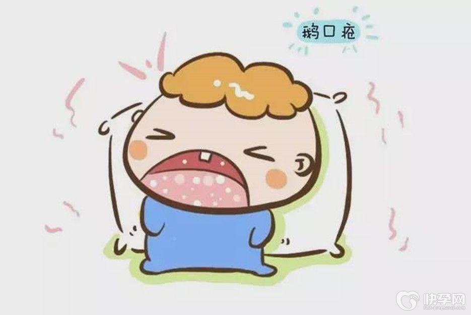 幼儿鹅口疮起因，鹅口疮最佳治疗方法-五个治疗摆脱鹅口疮没烦恼