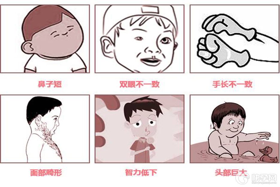 4类孕妇易生唐氏儿，孕妈们千万不要掉以轻心