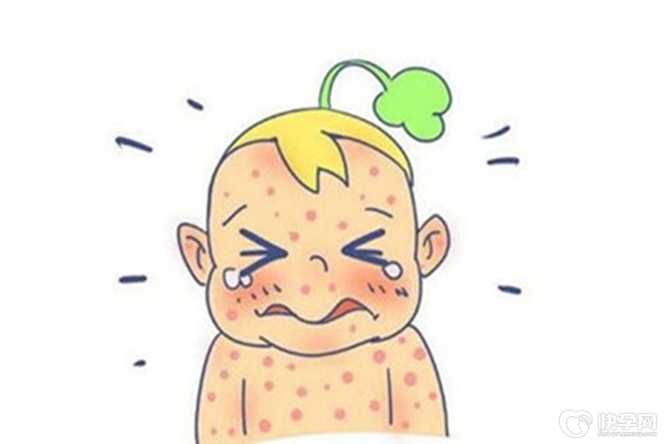 幼儿急疹一般几个小时烧一次，幼儿急疹发病特点家长请记牢