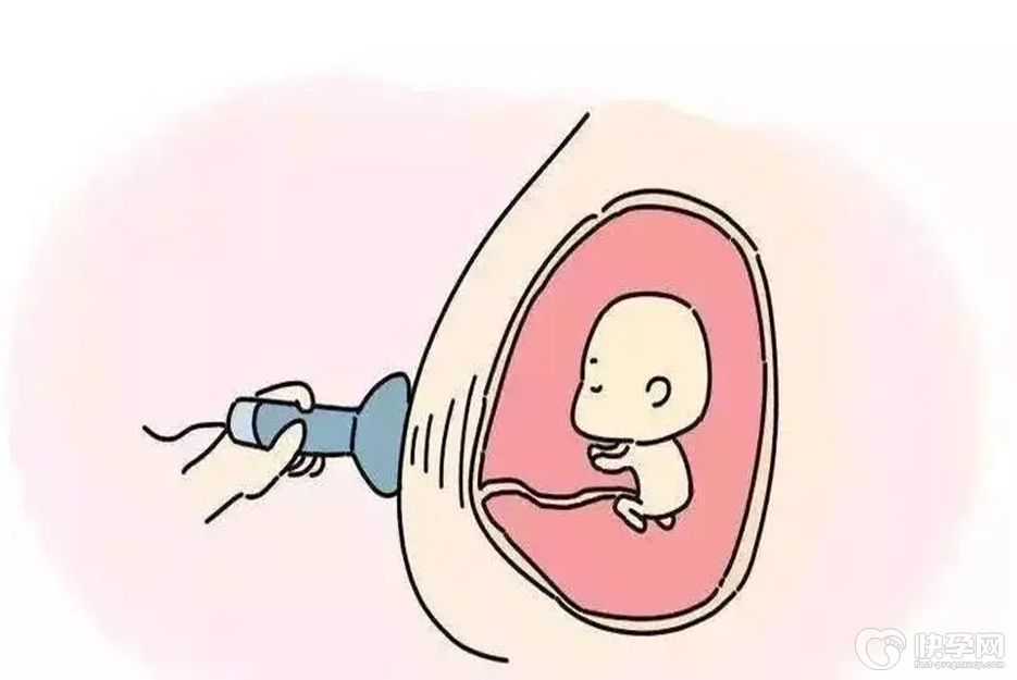 大排畸看男孩女孩诀窍，学会一眼看穿轻松辨别