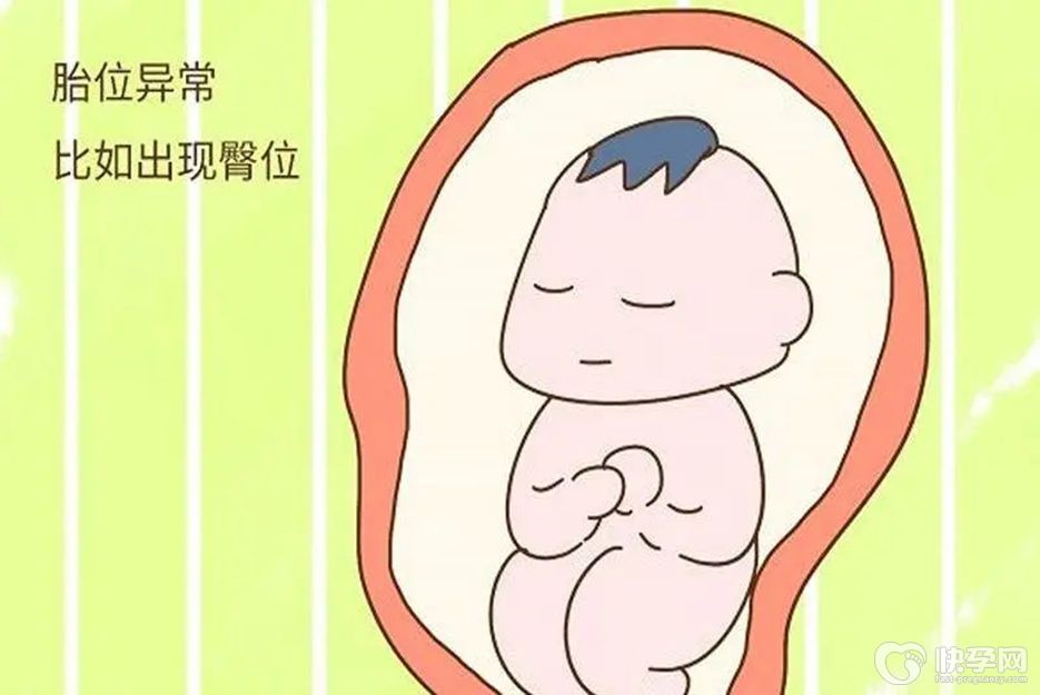 为什么臀位宝宝发育不健康，纯属无稽之谈，真正的危害要了解