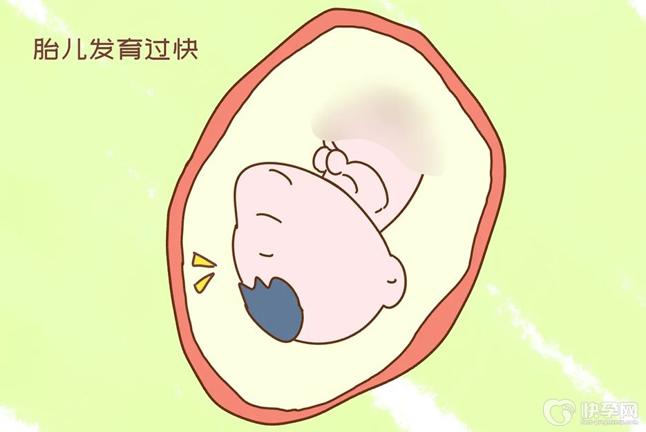 胎儿腹围偏大说明什么？孕妈还不赶紧看看