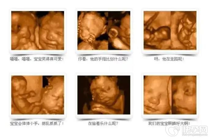 最明显的女宝b超图，一分钟看懂B超怎么分析出男女