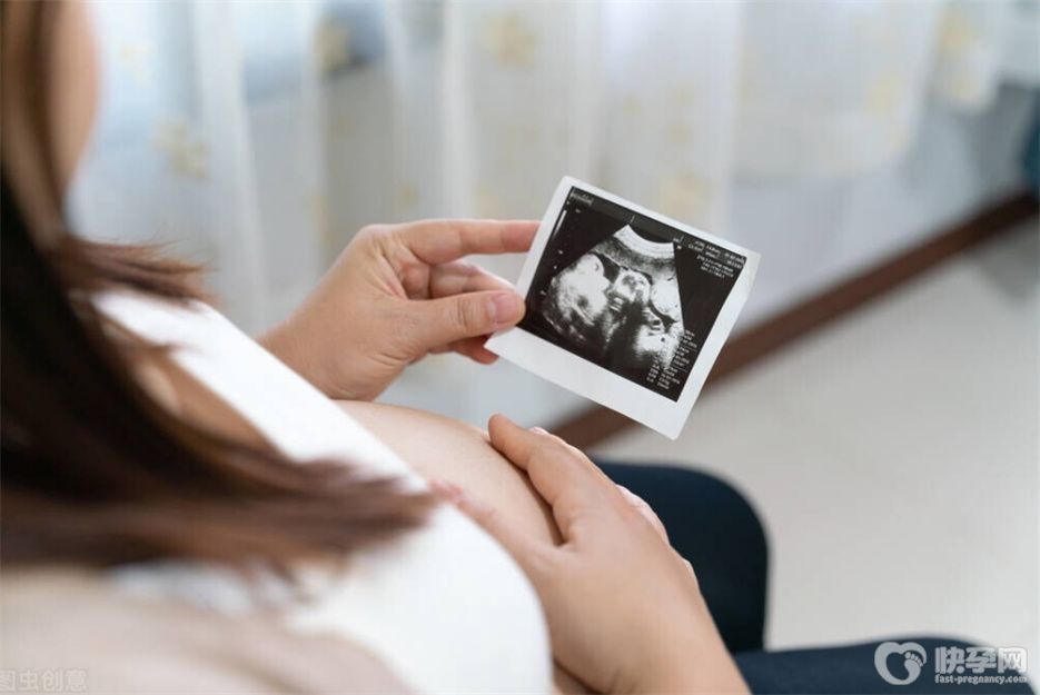 b超单有这个一般是女孩，四维单子3秒钟看男是女