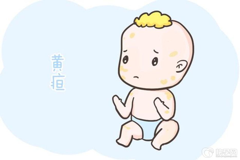 母乳性黄疸的三大特征，别让无知耽误宝宝一辈子