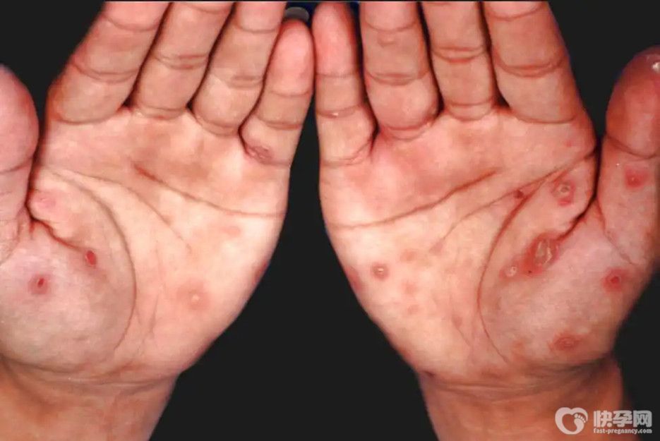 男性得性疾病后八大症状图片，中一种也要及时检查