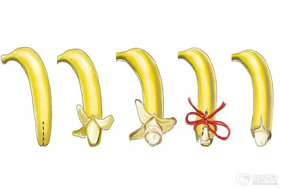 小孩子做包茎手术几岁合适，听听生殖专家怎么说