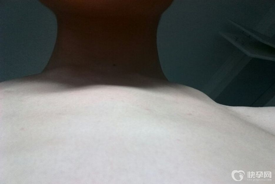 鸡胸从轻度到重度图片参考，对比正常图区别一眼能辨