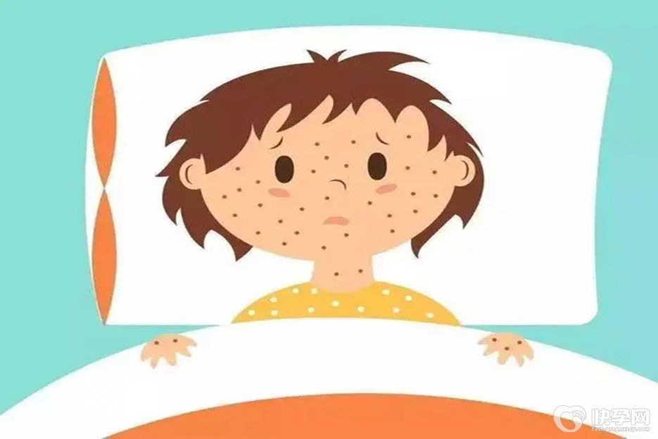 水痘自愈的最快方法，这6个战痘秘籍宝爸宝妈们必须掌握