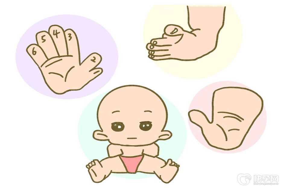 胎儿畸形的10大征兆，希望你一个都没有