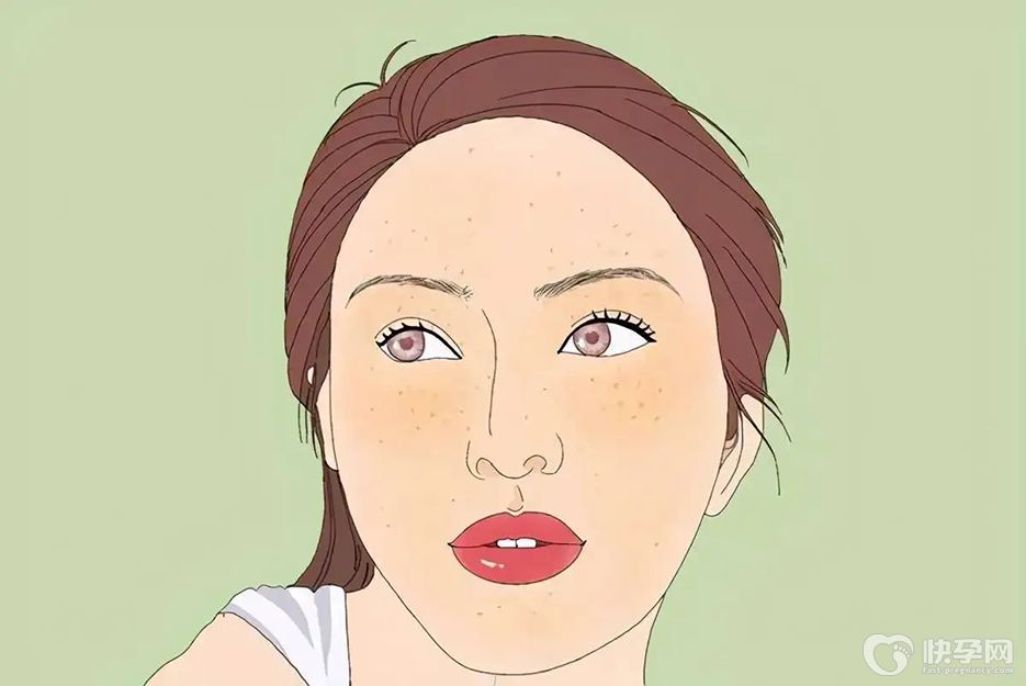 女人肝不好的5个表现，肝脏已不堪重负，别再视而不见!