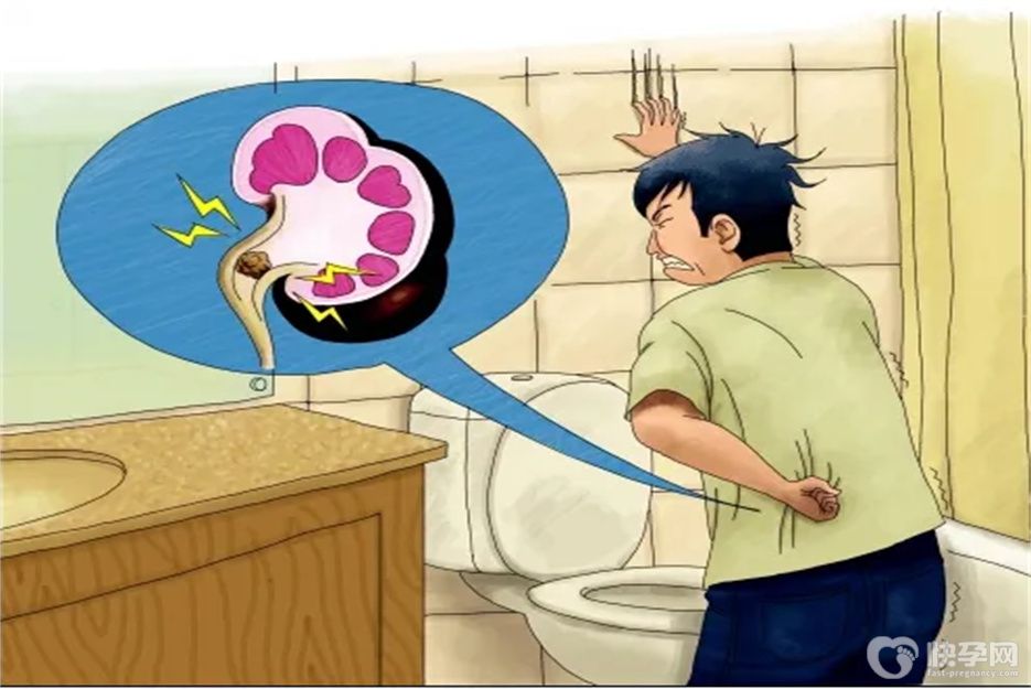 健康科普：结石怎么排出来最快方法，掌握六招轻松消除结石