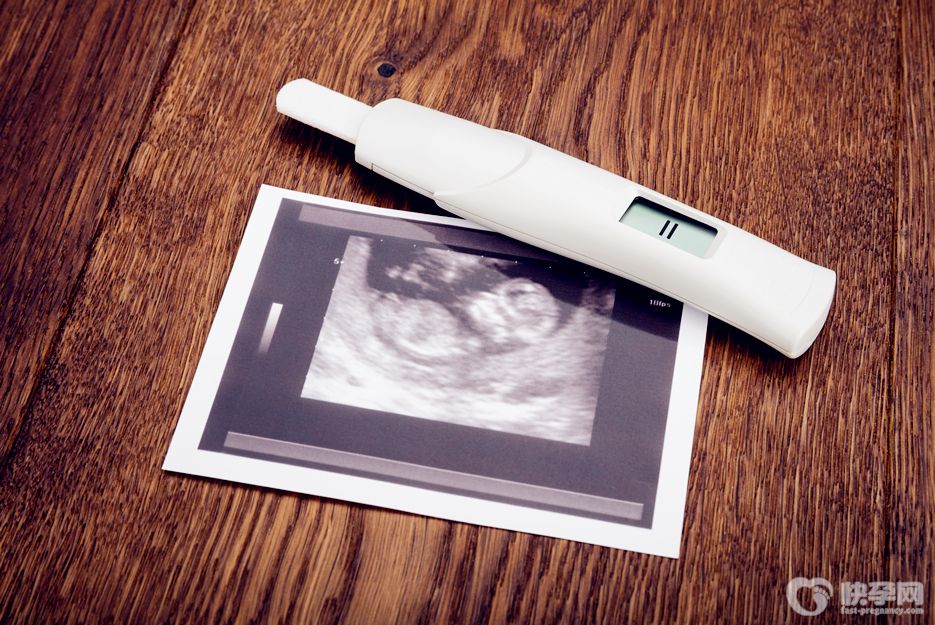 热点讨论：怎么测试怀孕？这四个方法测怀孕准爆了！