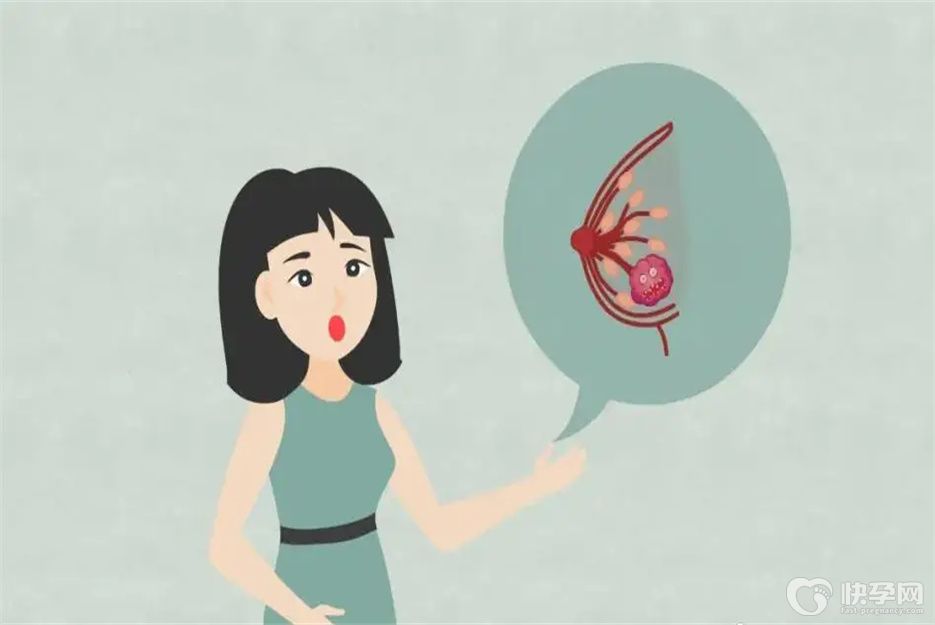 纤维瘤癌变之前的六个征兆，已经帮你揪出来了千万别轻视