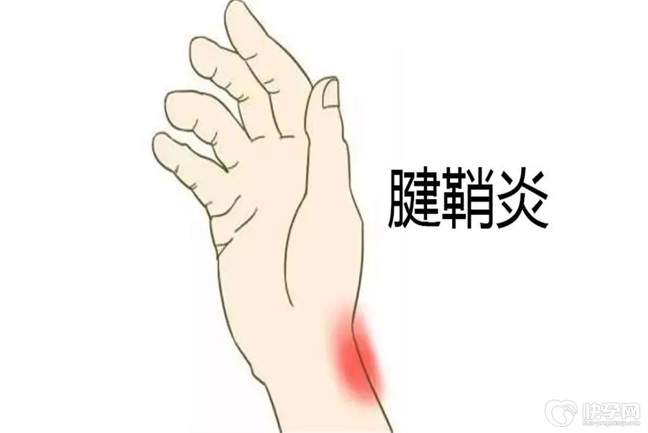 优质资讯：腱鞘炎3个动作自愈方法，让你手指重回灵活