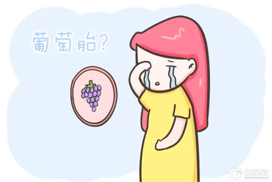 有过葡萄胎史的如何备孕？听听妇科专家怎么说