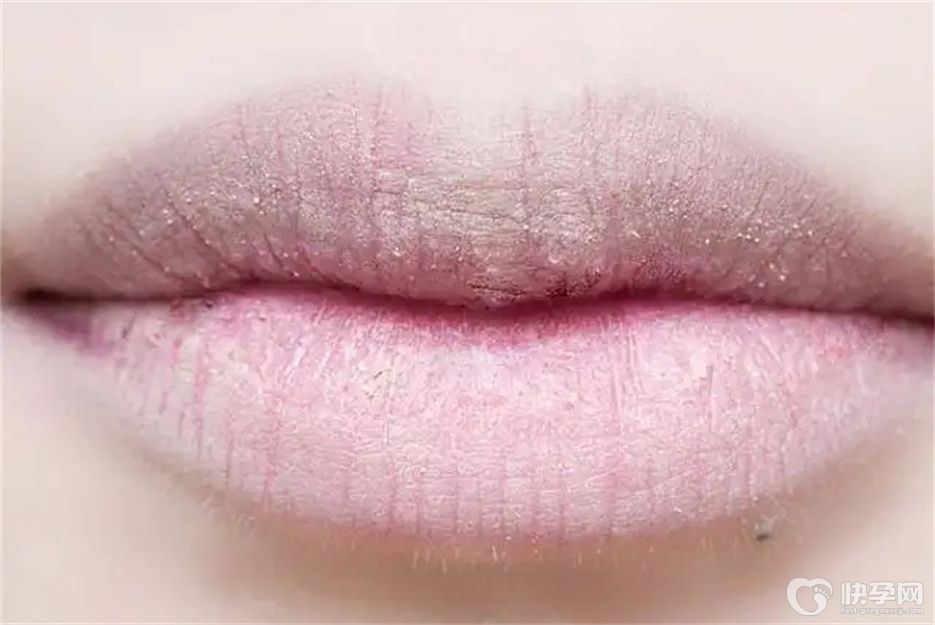 唇炎最怕三种水果，轻松改善嘴唇起皮