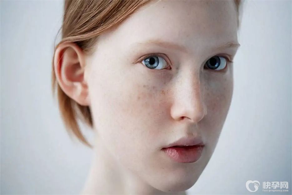 脸上有斑最忌讳吃什么？不想满脸斑这七种食物要忌口