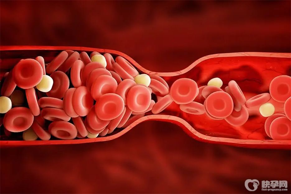 血液粘稠的人有哪些表现？身体出现这3个情况时不可大意