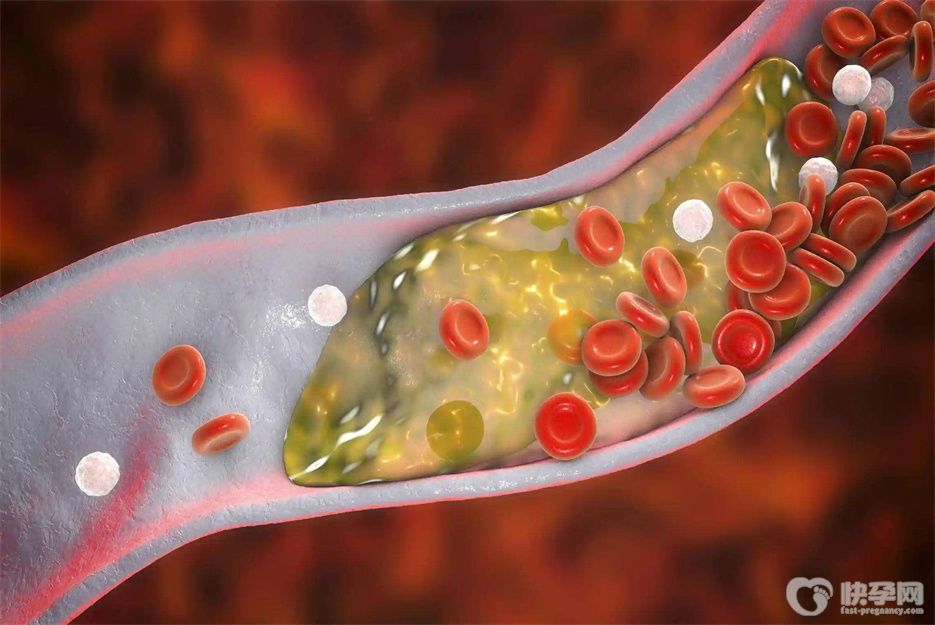 血脂高的人不能吃什么食物？这7大食物坚决不能碰