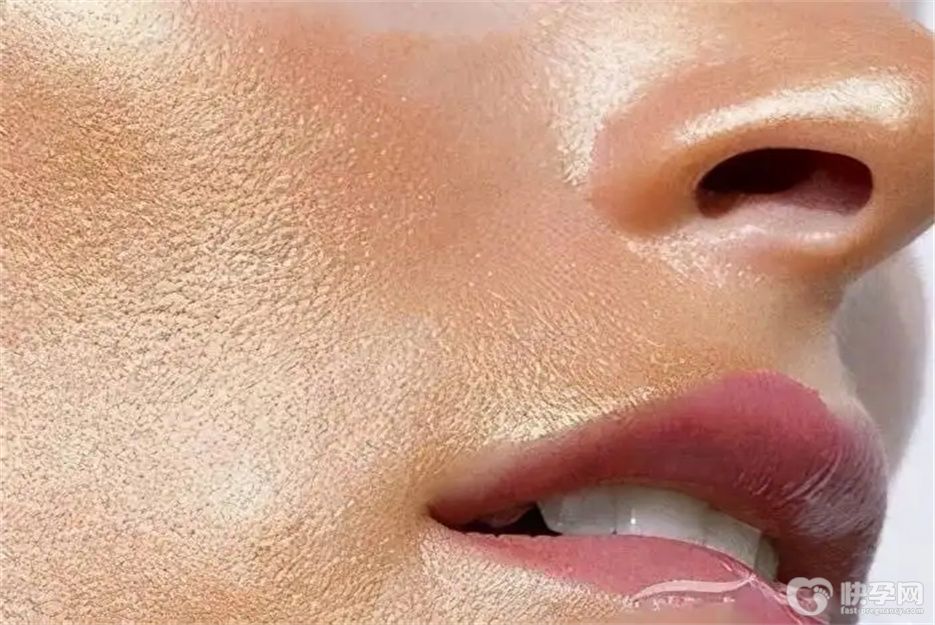 盘点脸上去油最好的6个方法，让你告别脸部油腻