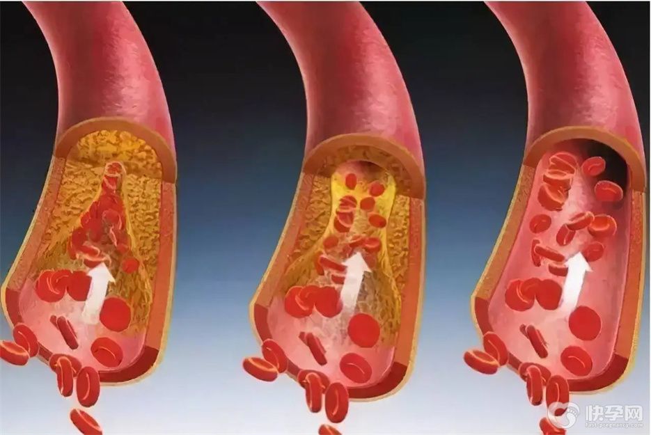 清理血管的十种蔬菜，常吃帮助你赶跑血栓