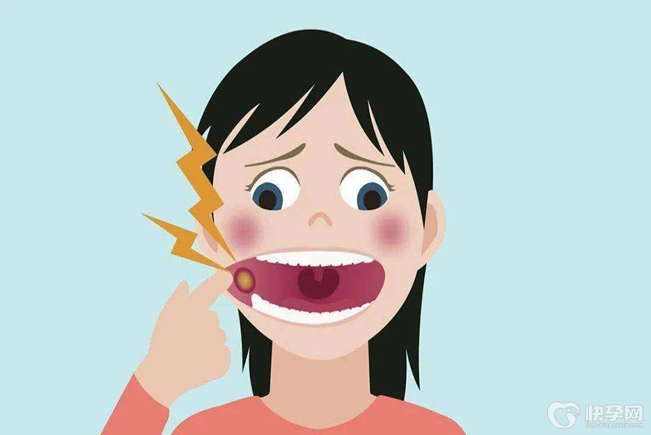盘点治疗孕妇口腔溃疡的小妙招，让你孕期再无忧虑