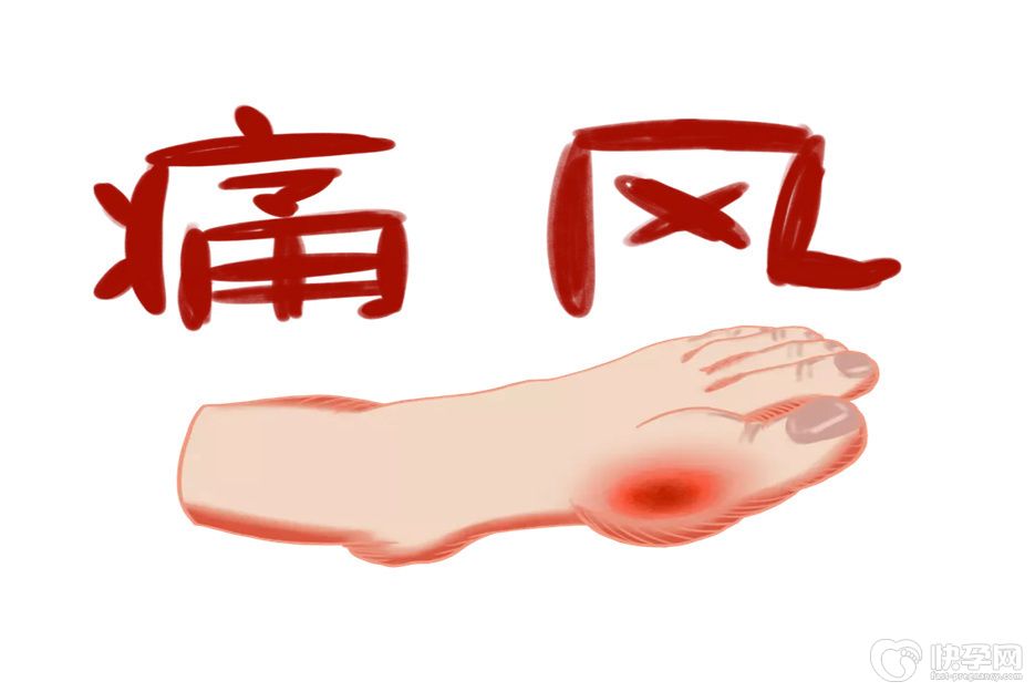 痛风不能吃哪些蔬菜？这七种食物大忌