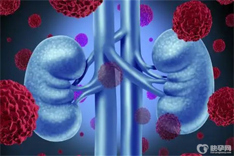 尿毒症患者可以吃什么水果？这四种水果是不错之选