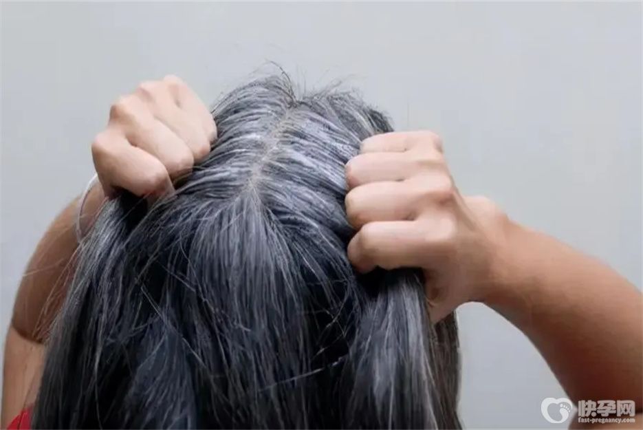 白头发吃什么能变黑？常吃八物或许能帮到你