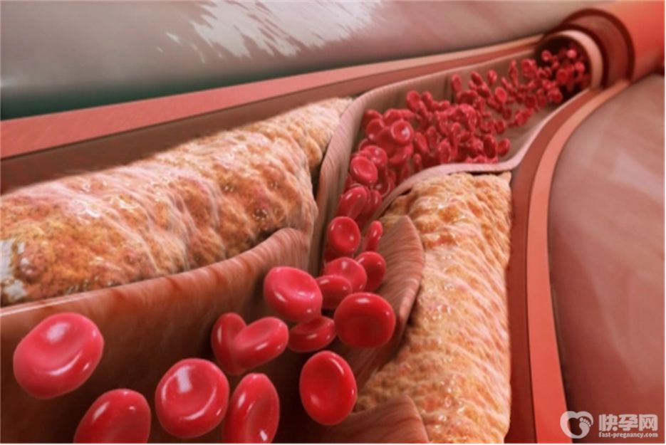 吃什么可以软化血管？常吃六物轻松帮你清理血管垃圾