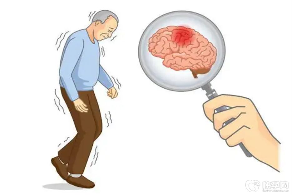 脑梗有四种食物不能吃，为了健康再喜欢也要忍住