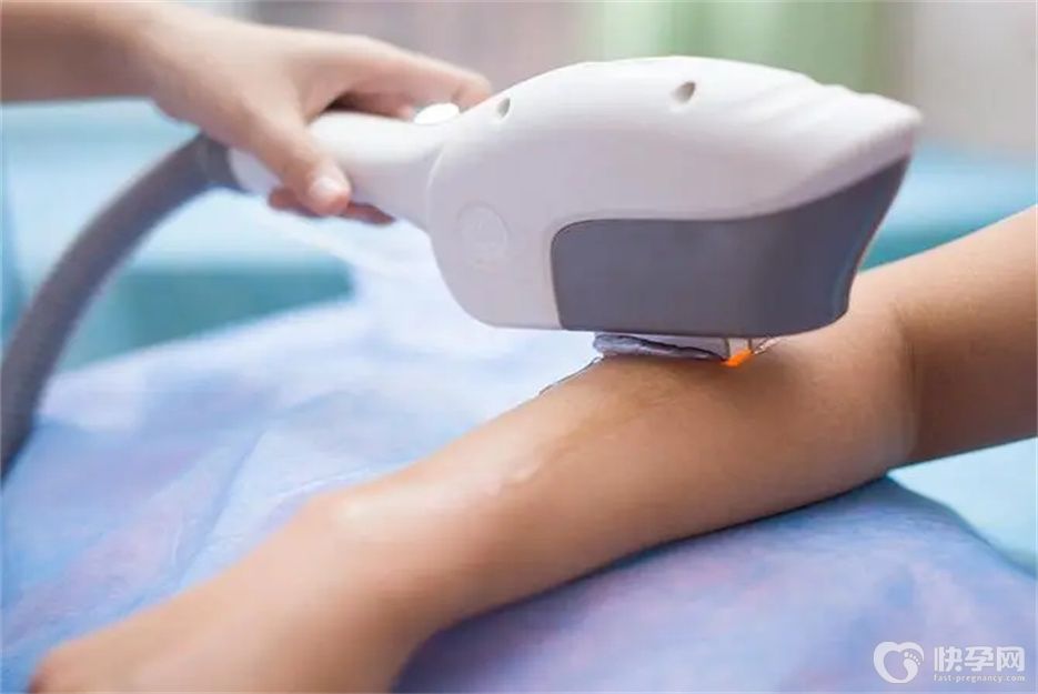 激光脱毛对身体有什么危害？小心带来5大危害