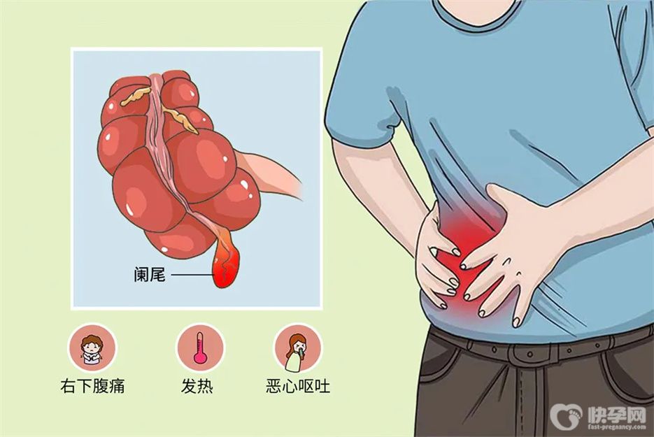 阑尾炎吃什么食物好， 这六款食疗方法是不错之选