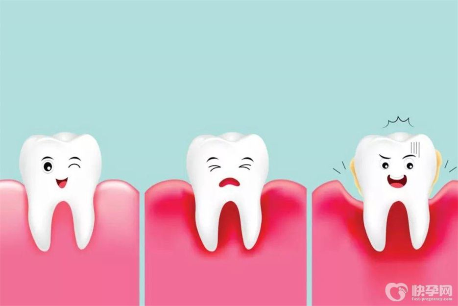 牙龈肿痛怎么快速消肿去火？做好这六点至关重要