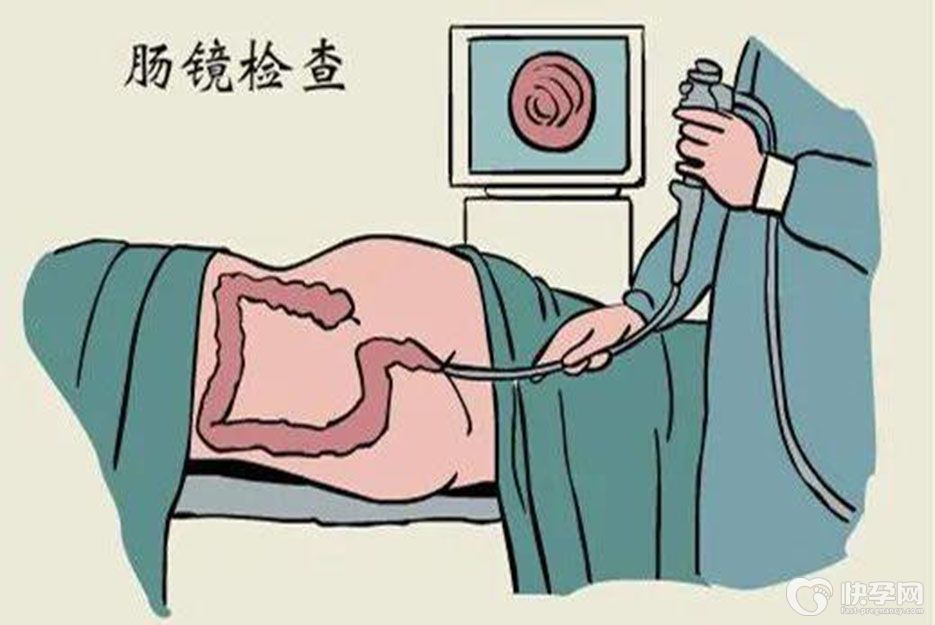 科普肠镜什么情况下需要做？五种情况建议做肠镜检查