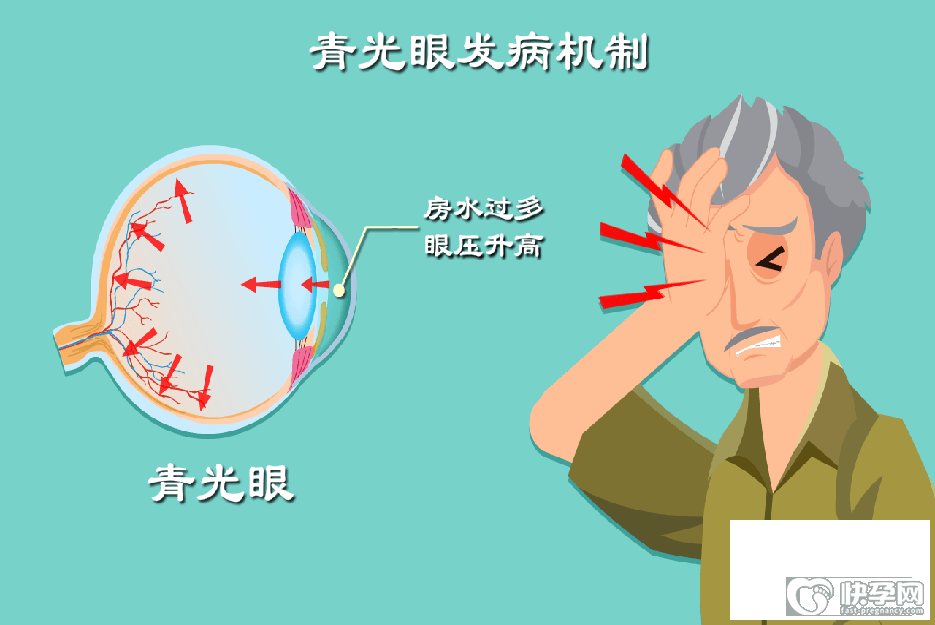 青光眼不能吃食物列表，这6类食物最好不要沾