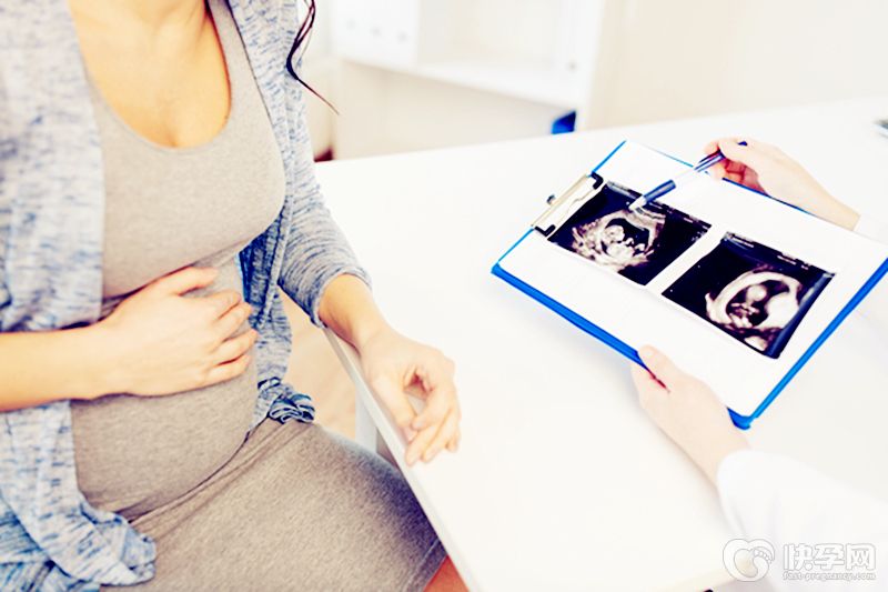 四维单子上m和f在哪？一文释疑四维彩超上的英文字母mf代表什么