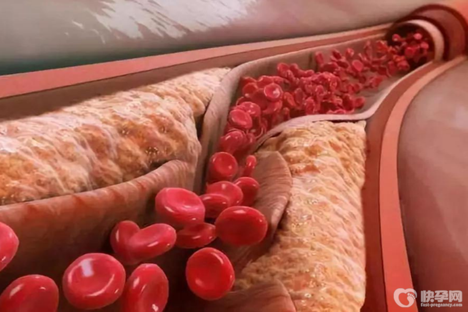 12种降低胆固醇的食物，别说你一样都吃不起