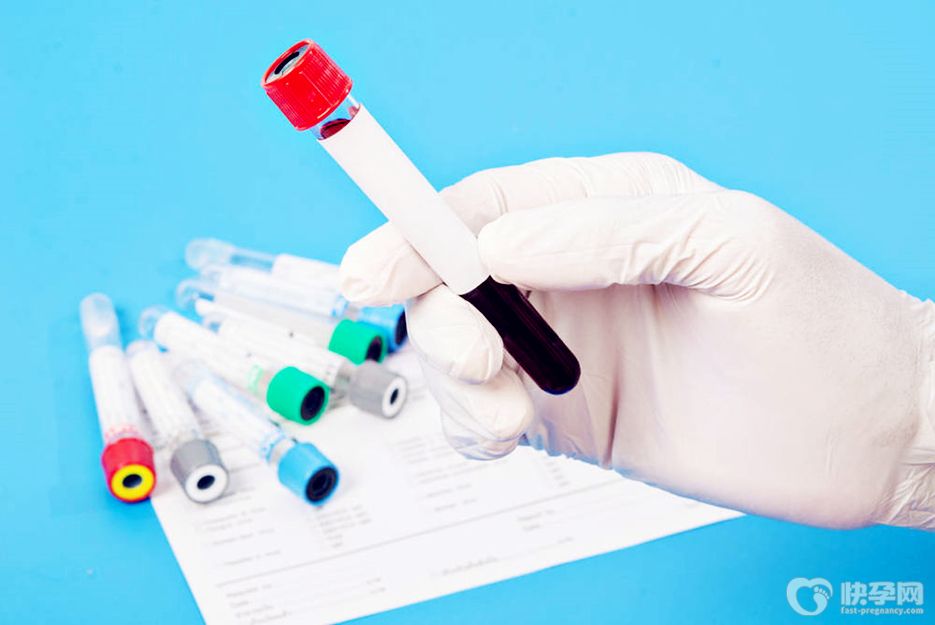 血清铁蛋白是检查什么？血清铁蛋白检查项目科普