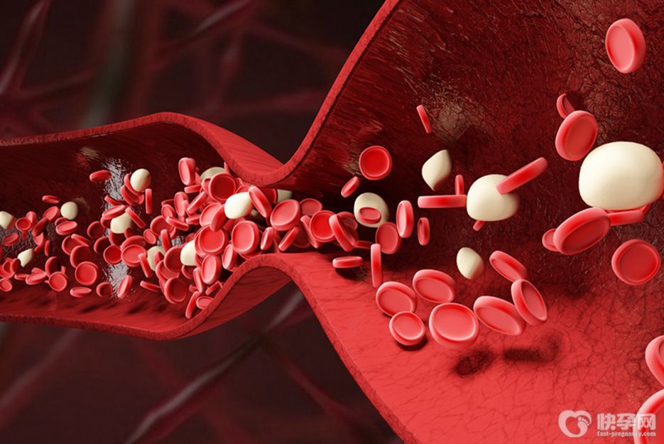 血管狭窄最怕三种食物，日常多吃保障血管健康